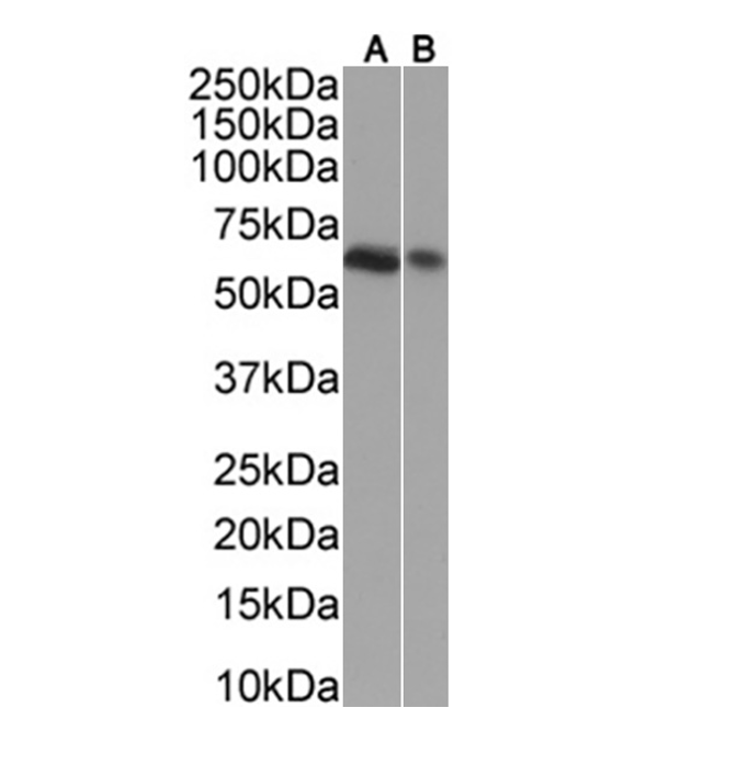WB using IQ212 (4D11) (0.001µg/ml) staining in Jurkat(A) and HepG2(B) cells nuclear lysate (35µg protein in RIPA buffer). Primary incubation was 1 hour. Detected by chemiluminescence.