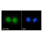 Immunofluorescence analysis of paraformaldehyde fixed MCF7 cells,  permeabilized with 0.15% Triton. Primary incubation 1hr (1:100 dilution) followed by Alexa Fluor® 488 secondary antibody (1:1000 dilution), showing nuclear staining (green). Nuclear stain is DAPI (blue).