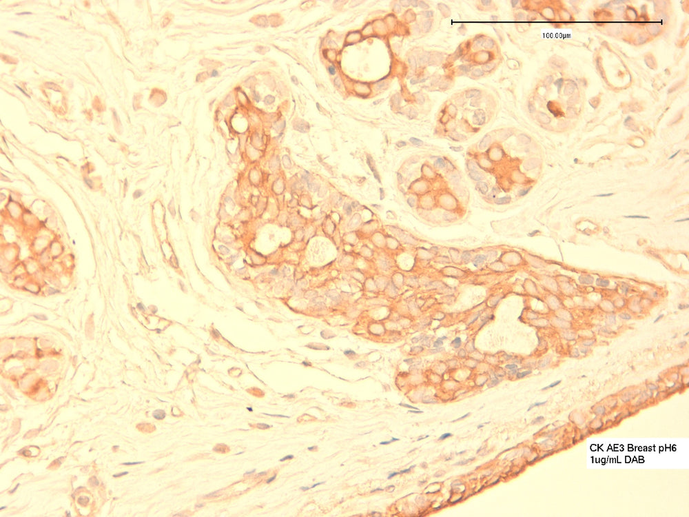 IHC using Cytokeratin [CK 211 (AE3)] antibody (IQ289) on Human breast tissue