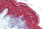 IHC using Cytokeratin 10-1 Antibody (IQ293) on Human skin