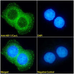 Immunofluorescence analysis of paraformaldehyde fixed MCF7 cells,  permeabilized with 0.15% Triton. Primary incubation 1hr (1:100 dilution) followed by Alexa Fluor® 488 secondary antibody (1:1000 dilution), showing cytoplasmic staining. The nuclear stain is DAPI (blue). Negative control: Mouse IgG1 negative control followed by Alexa Fluor® 488 secondary antibody.