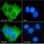 Immunofluorescence analysis of paraformaldehyde fixed MCF7 cells,  permeabilized with 0.15% Triton. Primary incubation 1hr (1:100 dilution) followed by Alexa Fluor® 488 secondary antibody (1:1000 dilution), showing cytoplasmic staining. The nuclear stain is DAPI (blue). Negative control: Mouse IgG1 negative control followed by Alexa Fluor® 488 secondary antibody