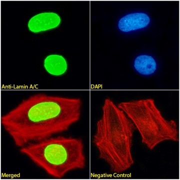 Immunofluorescence analysis of paraformaldehyde fixed HeLa cells,  permeabilized with 0.15% Triton. Primary incubation 1hr (1:100 dilution) followed by Alexa Fluor® 488 secondary antibody (1:1000 dilution), showing nuclear membrane and nucleoplasm staining. Actin filaments were stained with phalloidin (red) and the nuclear stain is DAPI (blue). Negative control: Mouse IgG1 negative control followed by Alexa Fluor® 488 secondary antibody.