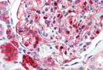 IHC using NQO1 Antibody (IQ342) clone A180 on Human Kidney