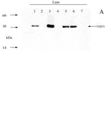  Immunoblot using NQO1 Antibody (IQ342) clone A180 and recombinant human NQO1 protein (Lane 1)