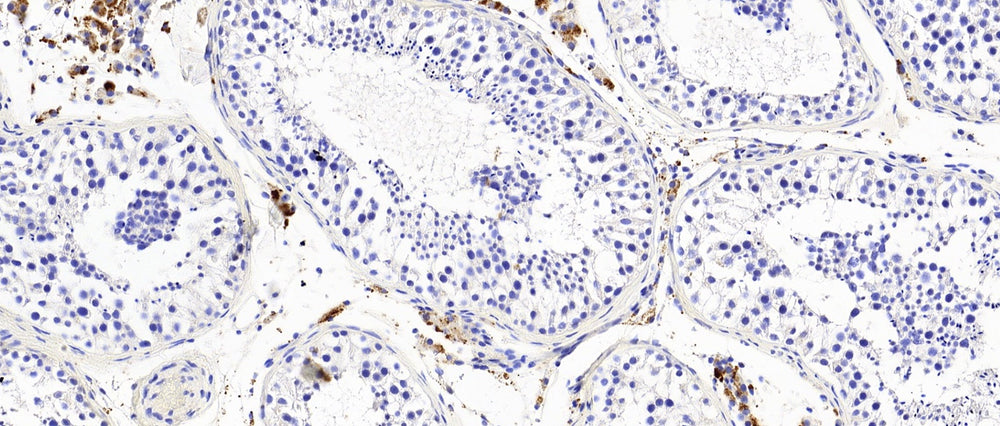 FFPE fixed adult human testis , stained with Testosterone Antibody (IQ396) clone FB83 at 1/100