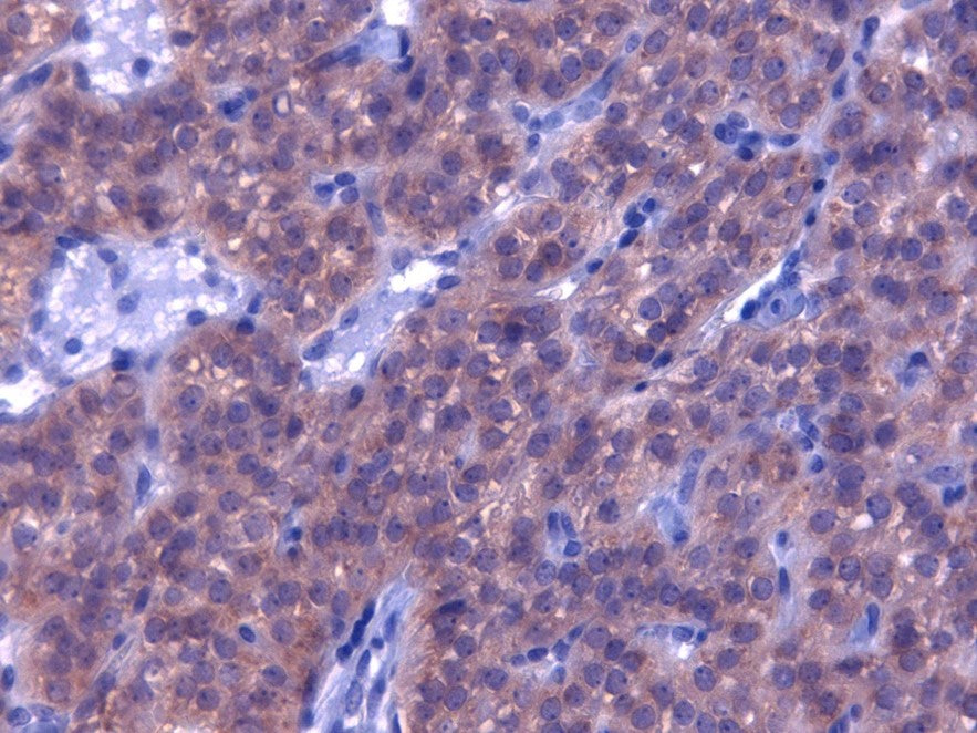 FFPE Normal human Parathyroid , stained with PTH Antibody (IQ399) clone BAM87 at 4ug/ml