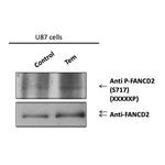 Western blot analysis  of U87 cells  either treated (RH) or untreated with temezolamide prior to analysis of total lysate either with indicated phospho-specific  antibody or anti-FANCD2 antibody by immunoblotting blotting. 