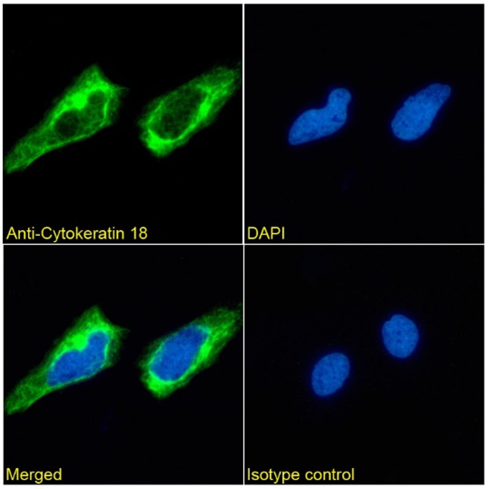 Immunofluorescence analysis of paraformaldehyde fixed HeLa cells. Primary incubation 1hr (1:50-1:100 dilution) followed by Alexa Fluor® 488 secondary antibody (1:1000 dilution), showing cytoplasmic staining. The nuclear stain is DAPI (blue). Isotype control: Anti-Fluorescein followed by Alexa Fluor® 488 secondary antibody.
