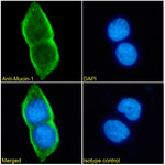 Immunofluorescence analysis of paraformaldehyde fixed MCF7 cells. Primary incubation 1hr (1:50-1:100 dilution) followed by Alexa Fluor® 488 secondary antibody (1:1000 dilution), showing membrane staining. The nuclear stain is DAPI (blue). Isotype control: Anti-Fluorescein followed by Alexa Fluor® 488 secondary antibody.