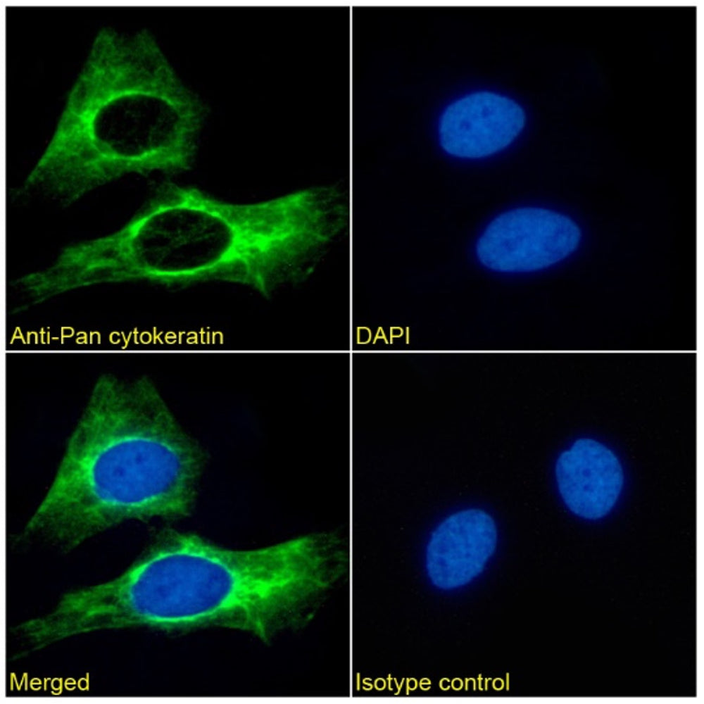 Immunofluorescence analysis of paraformaldehyde fixed HeLa cells. Primary incubation 1hr (1:50-1:100 dilution) followed by Alexa Fluor® 488 secondary antibody (1:1000 dilution), showing cytoplasmic staining. The nuclear stain is DAPI (blue). Isotype control: Anti-Fluorescein followed by Alexa Fluor® 488 secondary antibody.
