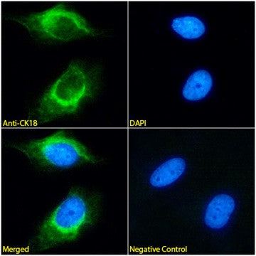 Immunofluorescence analysis of paraformaldehyde fixed HeLa cells,  permeabilized with 0.15% Triton. Primary incubation 1hr (1:100 dilution) followed by Alexa Fluor® 488 secondary antibody (1:1000 dilution), showing cytoplasmic staining. The nuclear stain is DAPI (blue). Negative control: Mouse IgG1 negative control followed by Alexa Fluor® 488 secondary antibody.