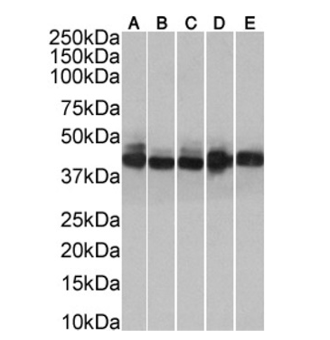 (0.001µg/ml) staining in A431(A), HeLa(B), MCF7(C), HepG2(D) and A549(E) cells lysate (35µg protein in RIPA buffer). Primary incubation was 1 hour. Detected by chemiluminescence.