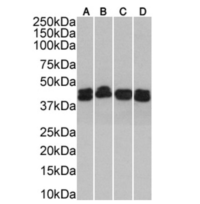 (0.001µg/ml) staining in A431(A), HeLa(B), MCF7(C) and HepG2(D) cells lysate (35µg protein in RIPA buffer). Primary incubation was 1 hour. Detected by chemiluminescence.