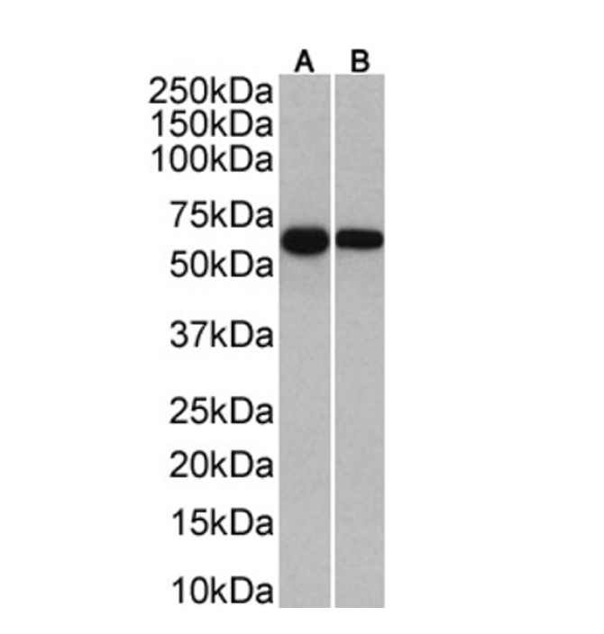 (0.01µg/ml) staining in human plasma(A) and serum(B) (35µg protein in RIPA buffer). Primary incubation was 1 hour. Detected by chemiluminescence.