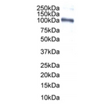 WB legend:  Western blotting of T47D cell nuclear extract (50µg protein in RIPA buffer) using 1064/E2 antibody at 10ug/ml. Band at approx. 118kD
