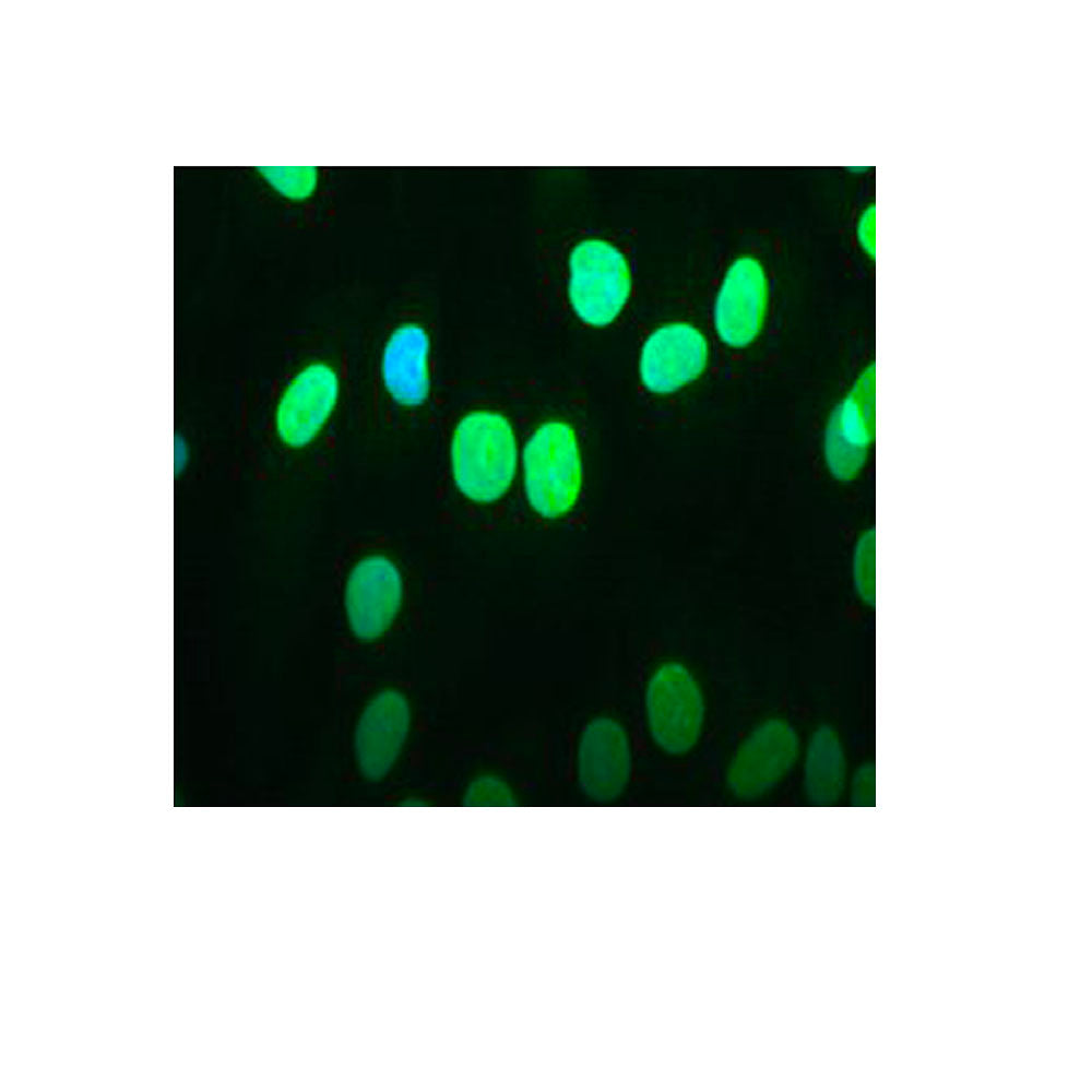 IF - Emerin Monoclonal Antibody [MANEM1(5D10)] on normal Human fibroblasts