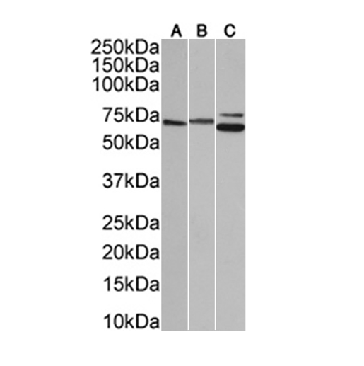 (1:1000) staining in A431(A), (1:10000) staining in HeLa(B), and (1:1000) staining in HepG2(C) cells nuclear lysate (35µg protein in RIPA buffer). Primary incubation was 1 hour. Detected by chemiluminescence.
