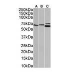 (1:1000) staining in A431(A), (1:10000) staining in HeLa(B), and (1:1000) staining in HepG2(C) cells nuclear lysate (35µg protein in RIPA buffer). Primary incubation was 1 hour. Detected by chemiluminescence.