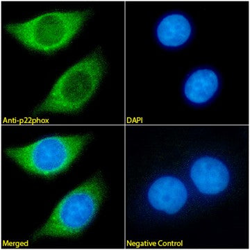 Immunofluorescence analysis of paraformaldehyde fixed MCF7 cells. Primary incubation 1hr (1:100 dilution) followed by Alexa Fluor® 488 secondary antibody (1:1000 dilution), showing cytoplasmic staining. The nuclear stain is DAPI (blue). Negative control: Mouse IgG1 negative control followed by Alexa Fluor® 488 secondary antibody.