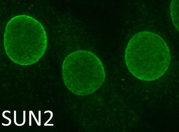 IF using SUN2 Antibody (IQ444) and mouse NIH 3T3 cells